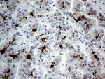 ABCB1 Antibody in Immunohistochemistry (Paraffin) (IHC (P))