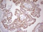 ABCB1 Antibody in Immunohistochemistry (Paraffin) (IHC (P))