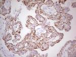 ABCB1 Antibody in Immunohistochemistry (Paraffin) (IHC (P))