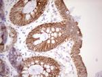 ABCB1 Antibody in Immunohistochemistry (Paraffin) (IHC (P))