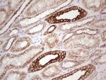 ABCB1 Antibody in Immunohistochemistry (Paraffin) (IHC (P))