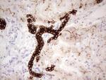 ABCB1 Antibody in Immunohistochemistry (Paraffin) (IHC (P))