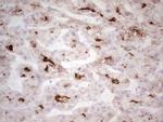 ABCB1 Antibody in Immunohistochemistry (Paraffin) (IHC (P))