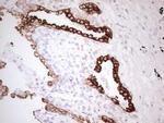 ABCB1 Antibody in Immunohistochemistry (Paraffin) (IHC (P))