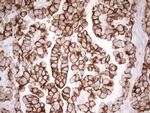 ABCB1 Antibody in Immunohistochemistry (Paraffin) (IHC (P))