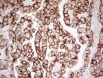 ABCB1 Antibody in Immunohistochemistry (Paraffin) (IHC (P))