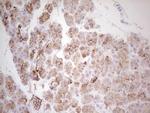 ABCB1 Antibody in Immunohistochemistry (Paraffin) (IHC (P))