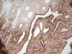 ABCB1 Antibody in Immunohistochemistry (Paraffin) (IHC (P))