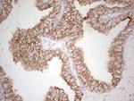 ABCB1 Antibody in Immunohistochemistry (Paraffin) (IHC (P))