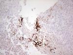 ABCB1 Antibody in Immunohistochemistry (Paraffin) (IHC (P))