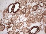 ABCB1 Antibody in Immunohistochemistry (Paraffin) (IHC (P))