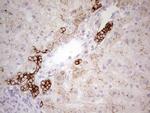 ABCB1 Antibody in Immunohistochemistry (Paraffin) (IHC (P))