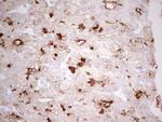 ABCB1 Antibody in Immunohistochemistry (Paraffin) (IHC (P))