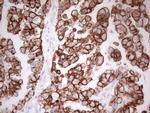 ABCB1 Antibody in Immunohistochemistry (Paraffin) (IHC (P))