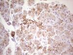 ABCB1 Antibody in Immunohistochemistry (Paraffin) (IHC (P))