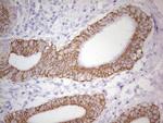 ABCB1 Antibody in Immunohistochemistry (Paraffin) (IHC (P))