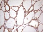 ABCB1 Antibody in Immunohistochemistry (Paraffin) (IHC (P))