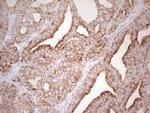 ABCB1 Antibody in Immunohistochemistry (Paraffin) (IHC (P))