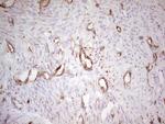 ABCB1 Antibody in Immunohistochemistry (Paraffin) (IHC (P))