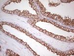 ABCB1 Antibody in Immunohistochemistry (Paraffin) (IHC (P))