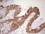 ABCB1 Antibody in Immunohistochemistry (Paraffin) (IHC (P))