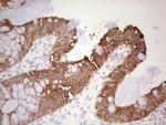 ABCB1 Antibody in Immunohistochemistry (Paraffin) (IHC (P))