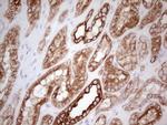 ABCB1 Antibody in Immunohistochemistry (Paraffin) (IHC (P))