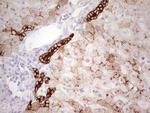 ABCB1 Antibody in Immunohistochemistry (Paraffin) (IHC (P))