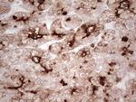 ABCB1 Antibody in Immunohistochemistry (Paraffin) (IHC (P))