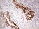 ABCB1 Antibody in Immunohistochemistry (Paraffin) (IHC (P))