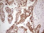 ABCB1 Antibody in Immunohistochemistry (Paraffin) (IHC (P))