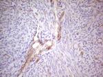 ABCB1 Antibody in Immunohistochemistry (Paraffin) (IHC (P))