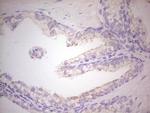 ABCB1 Antibody in Immunohistochemistry (Paraffin) (IHC (P))