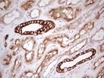 ABCB1 Antibody in Immunohistochemistry (Paraffin) (IHC (P))