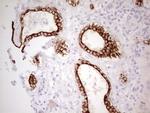 ABCB1 Antibody in Immunohistochemistry (Paraffin) (IHC (P))