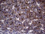 ABCB1 Antibody in Immunohistochemistry (Paraffin) (IHC (P))