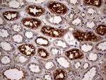 ABCB1 Antibody in Immunohistochemistry (Paraffin) (IHC (P))