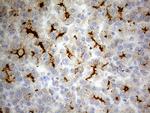 ABCB1 Antibody in Immunohistochemistry (Paraffin) (IHC (P))