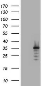 ABCB1 Antibody in Western Blot (WB)