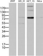 ABCB1 Antibody in Western Blot (WB)