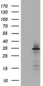 ABCB1 Antibody in Western Blot (WB)