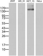 ABCB1 Antibody in Western Blot (WB)