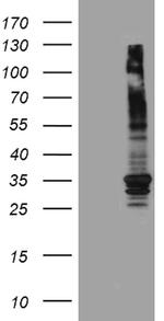 ABCB1 Antibody in Western Blot (WB)