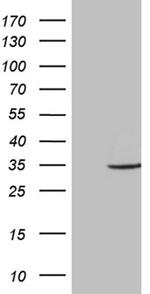 ABCB1 Antibody in Western Blot (WB)