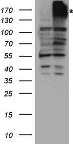 ABCB1 Antibody in Western Blot (WB)