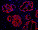 ABCB9 Antibody in Immunohistochemistry (IHC)