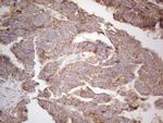 ABCC5 Antibody in Immunohistochemistry (Paraffin) (IHC (P))