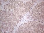 ABCC5 Antibody in Immunohistochemistry (Paraffin) (IHC (P))