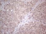 ABCC5 Antibody in Immunohistochemistry (Paraffin) (IHC (P))