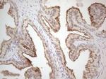 ABCC5 Antibody in Immunohistochemistry (Paraffin) (IHC (P))